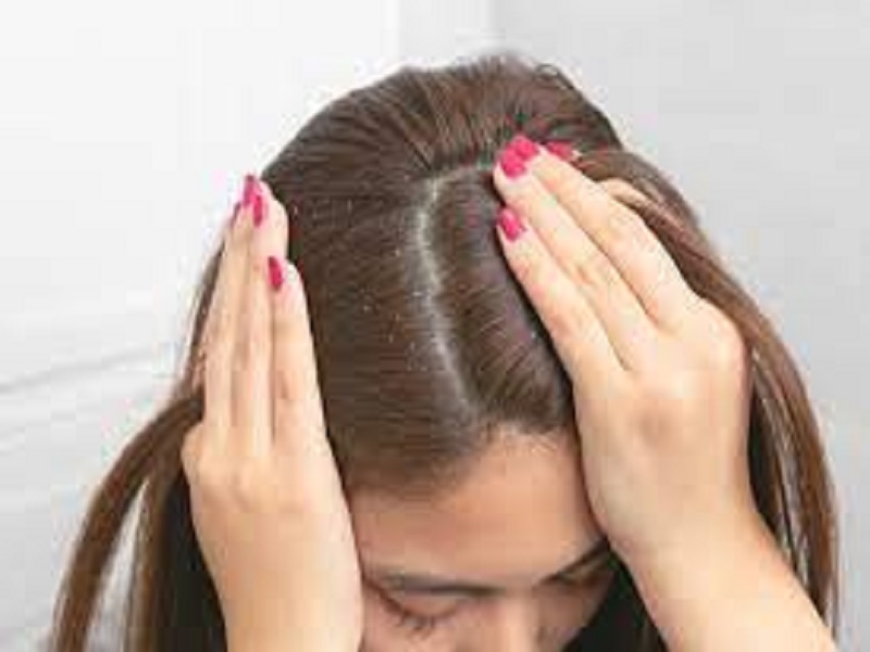 this is domestic treatment useful in hair dandruf and health for hair