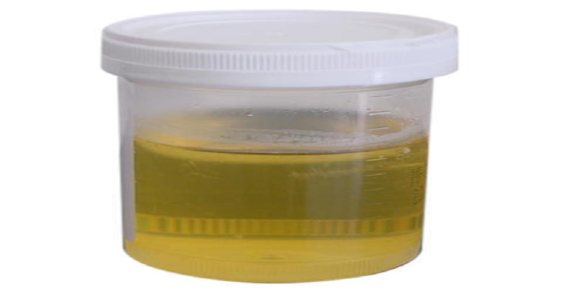 cow urine is more benificial to health that keep maintain fitness